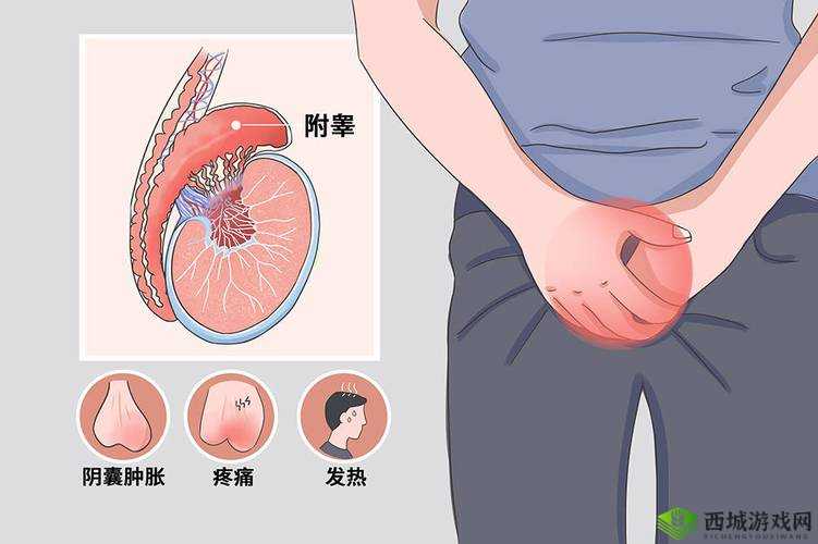 男生的小蛋蛋疼咋回事:原因大揭秘